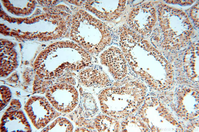 APOBEC4 Antibody in Immunohistochemistry (Paraffin) (IHC (P))