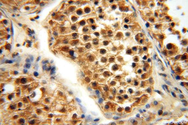 APOBEC4 Antibody in Immunohistochemistry (Paraffin) (IHC (P))