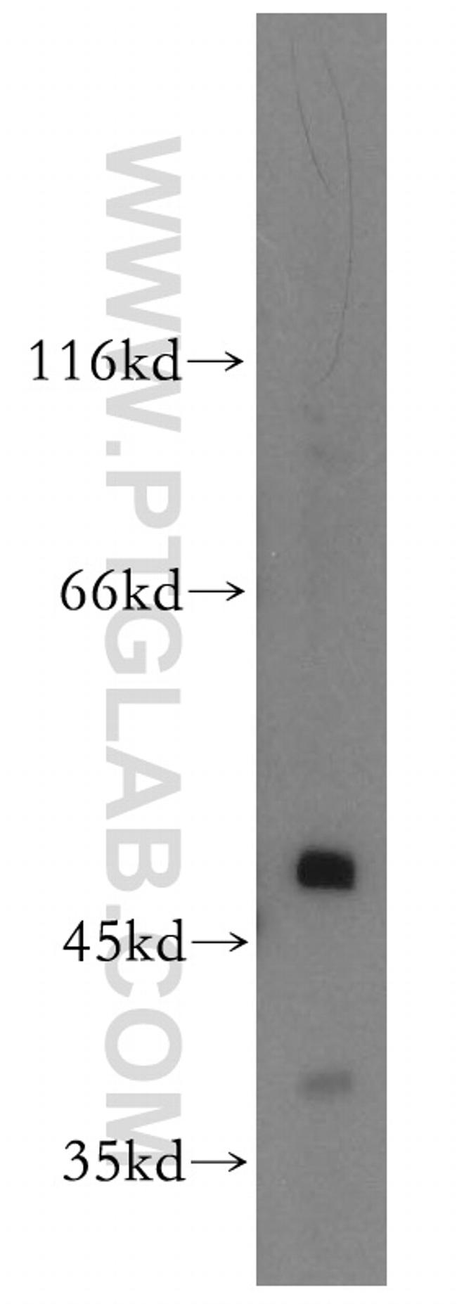 APOBEC4 Antibody in Western Blot (WB)