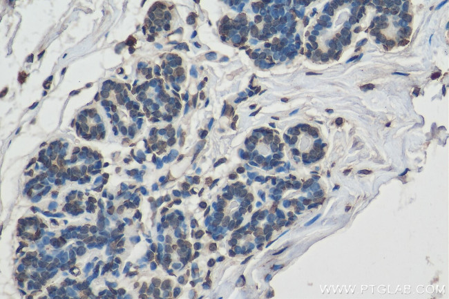 Histone-H3 Antibody in Immunohistochemistry (Paraffin) (IHC (P))