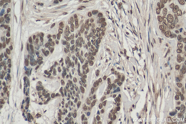 Histone-H3 Antibody in Immunohistochemistry (Paraffin) (IHC (P))