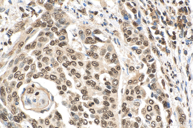 Histone-H3 Antibody in Immunohistochemistry (Paraffin) (IHC (P))