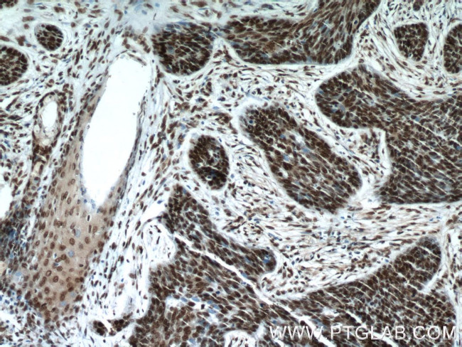 Histone-H3 Antibody in Immunohistochemistry (Paraffin) (IHC (P))