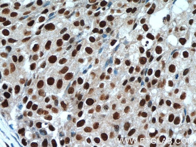 Histone-H3 Antibody in Immunohistochemistry (Paraffin) (IHC (P))