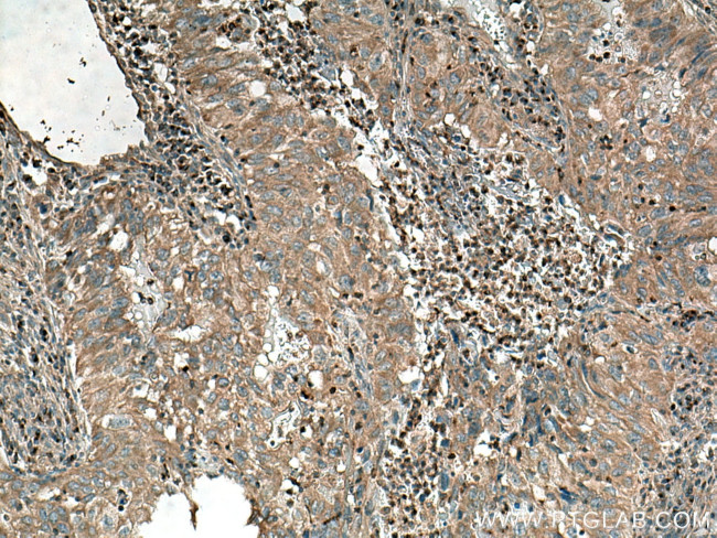 LOH12CR1 Antibody in Immunohistochemistry (Paraffin) (IHC (P))