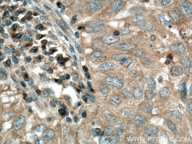 LOH12CR1 Antibody in Immunohistochemistry (Paraffin) (IHC (P))