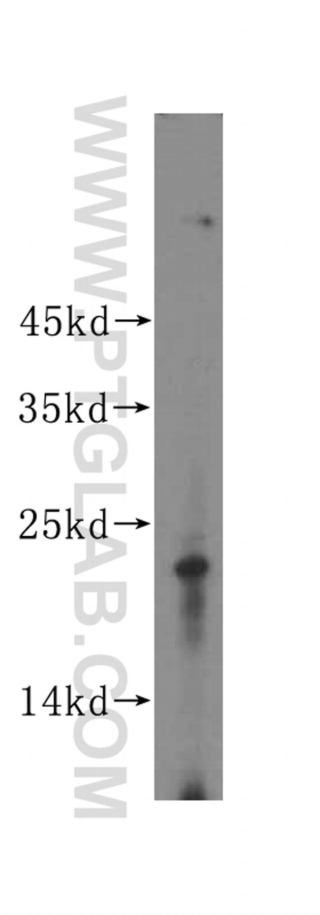 LOH12CR1 Antibody in Western Blot (WB)