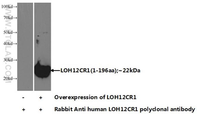 LOH12CR1 Antibody in Western Blot (WB)