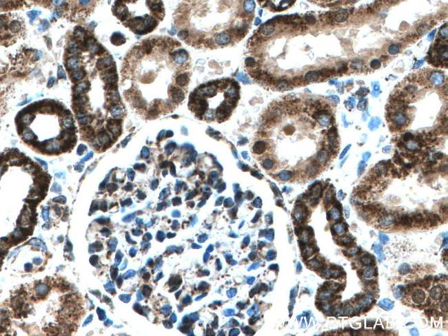 IARS2 Antibody in Immunohistochemistry (Paraffin) (IHC (P))