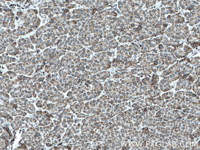 IARS2 Antibody in Immunohistochemistry (Paraffin) (IHC (P))