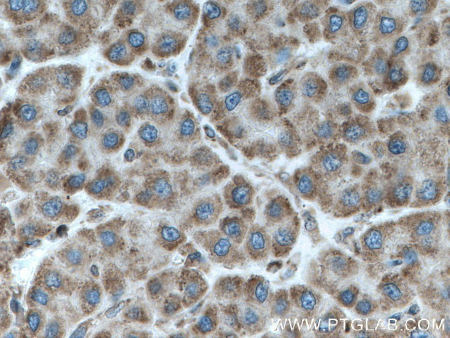 IARS2 Antibody in Immunohistochemistry (Paraffin) (IHC (P))