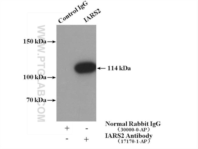 IARS2 Antibody in Immunoprecipitation (IP)