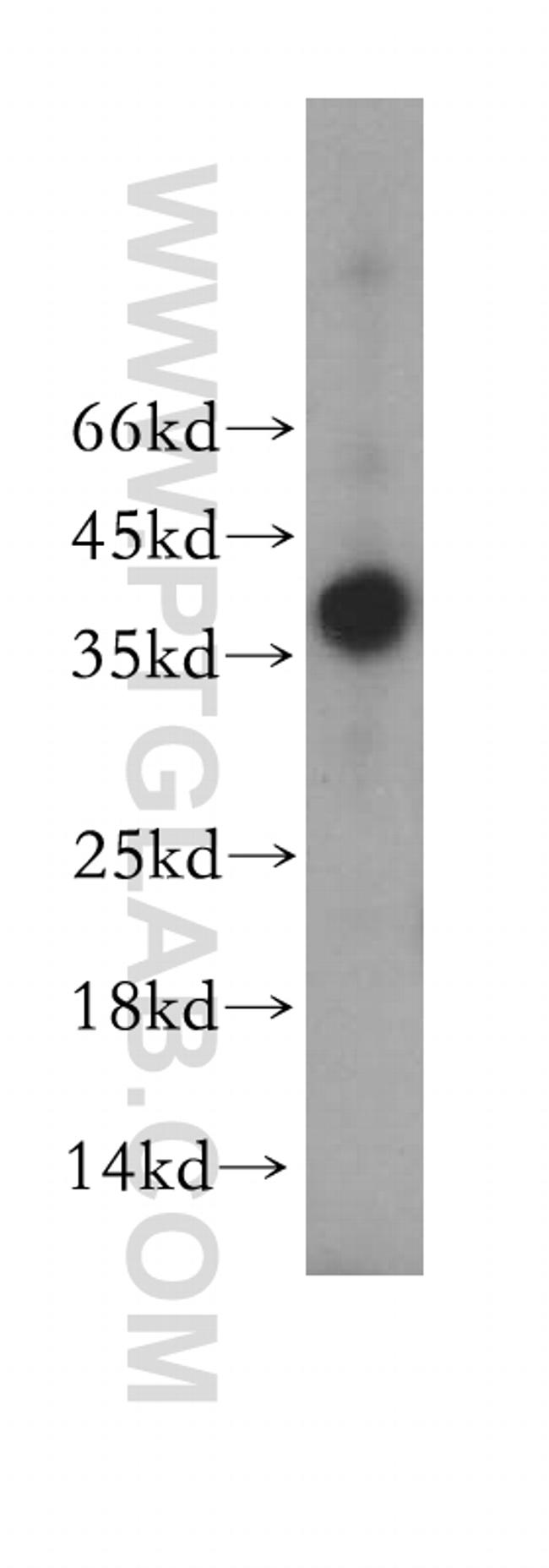 PSCA Antibody in Western Blot (WB)