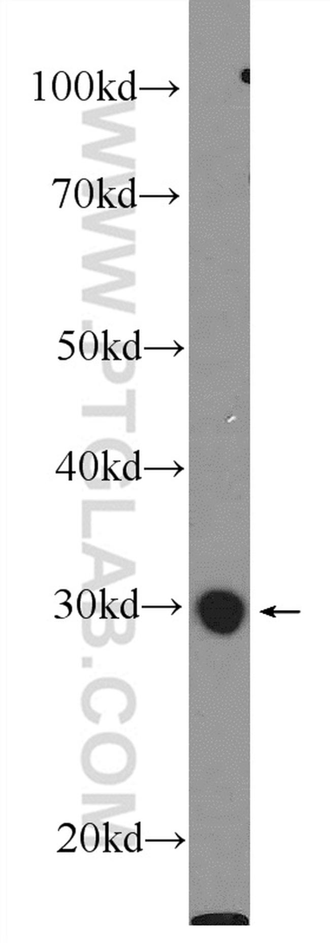 BPGM Antibody in Western Blot (WB)