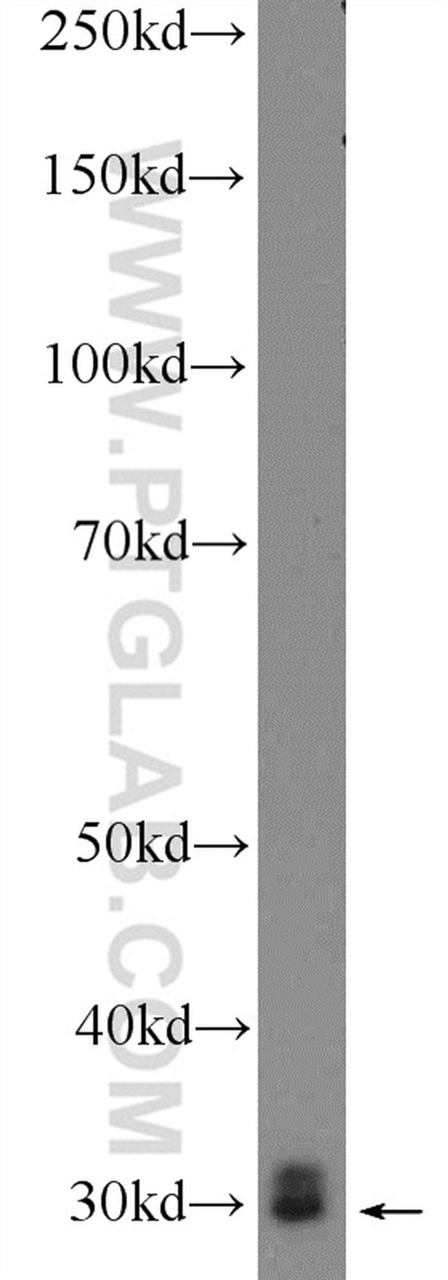 BPGM Antibody in Western Blot (WB)