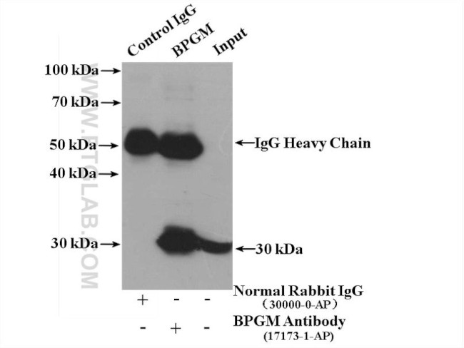 BPGM Antibody in Immunoprecipitation (IP)