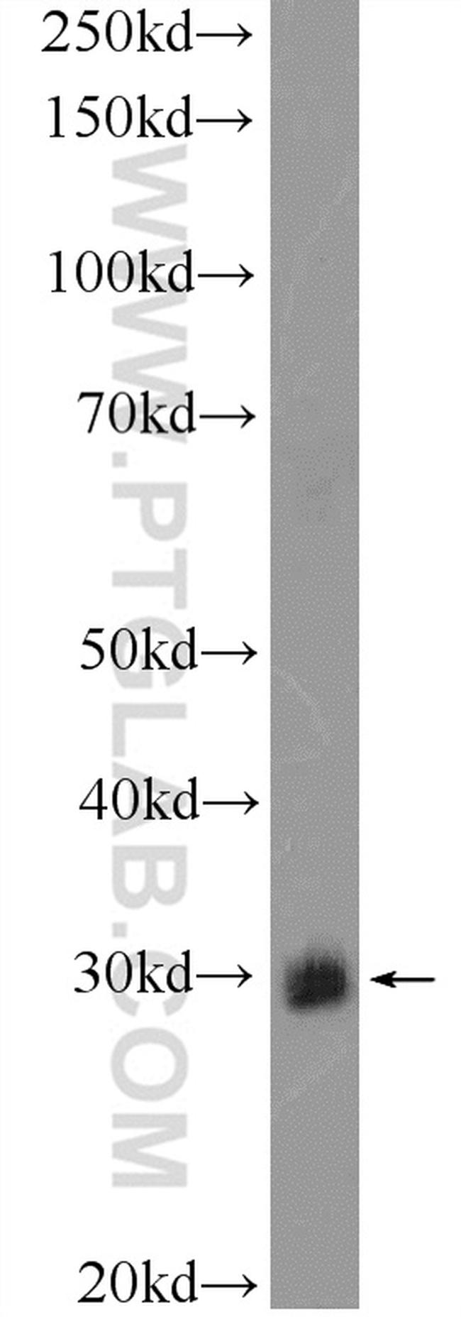 BPGM Antibody in Western Blot (WB)