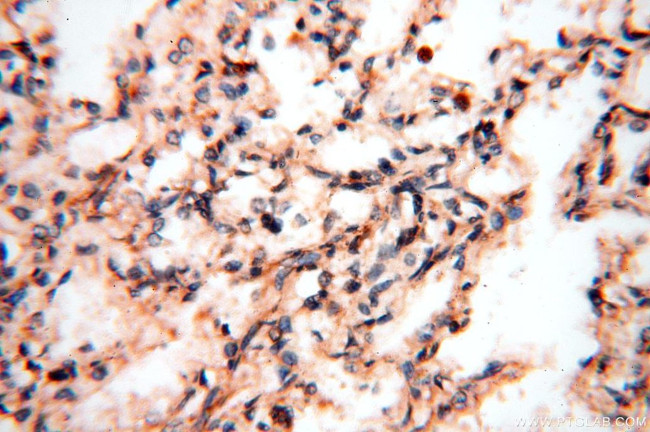 FUT11 Antibody in Immunohistochemistry (Paraffin) (IHC (P))