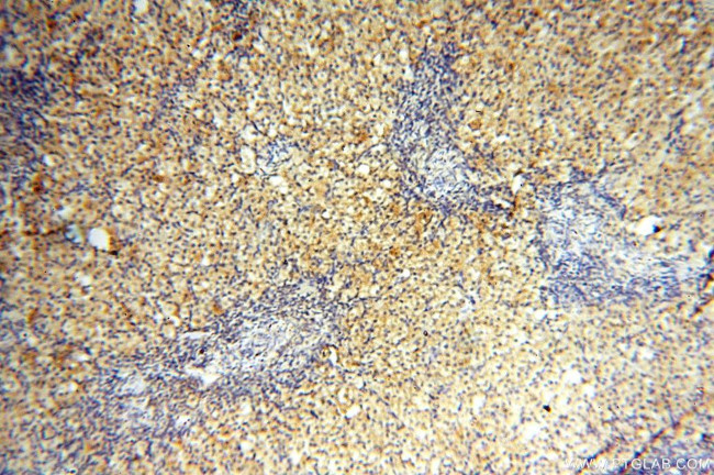 FUT11 Antibody in Immunohistochemistry (Paraffin) (IHC (P))