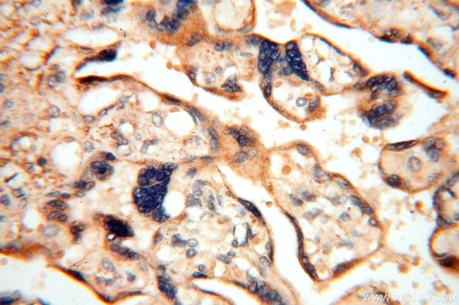 FUT11 Antibody in Immunohistochemistry (Paraffin) (IHC (P))