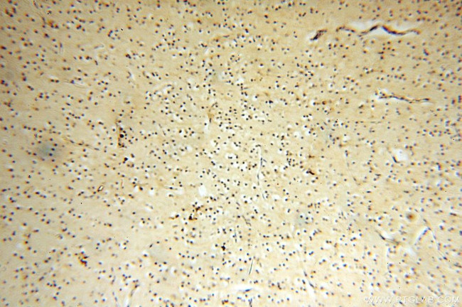 FUT11 Antibody in Immunohistochemistry (Paraffin) (IHC (P))