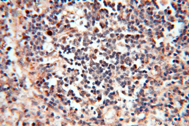 FUT11 Antibody in Immunohistochemistry (Paraffin) (IHC (P))