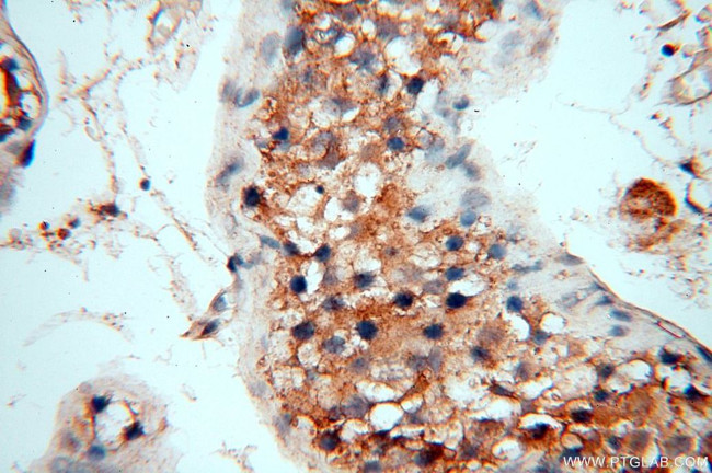 FUT11 Antibody in Immunohistochemistry (Paraffin) (IHC (P))