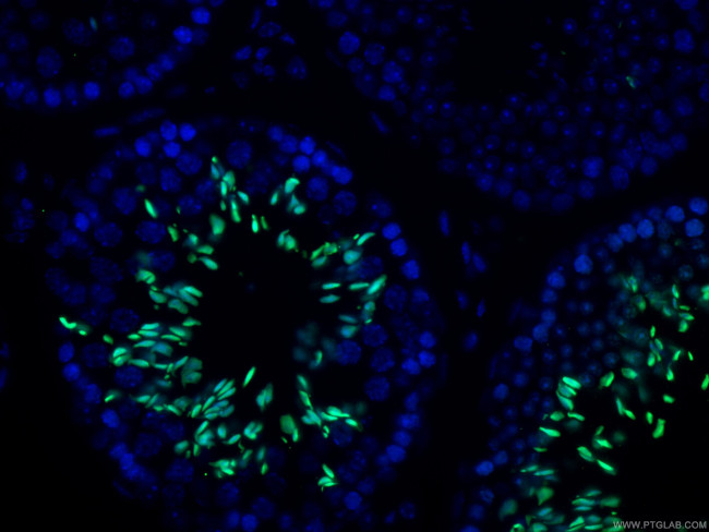 TNP1 Antibody in Immunohistochemistry (PFA fixed) (IHC (PFA))