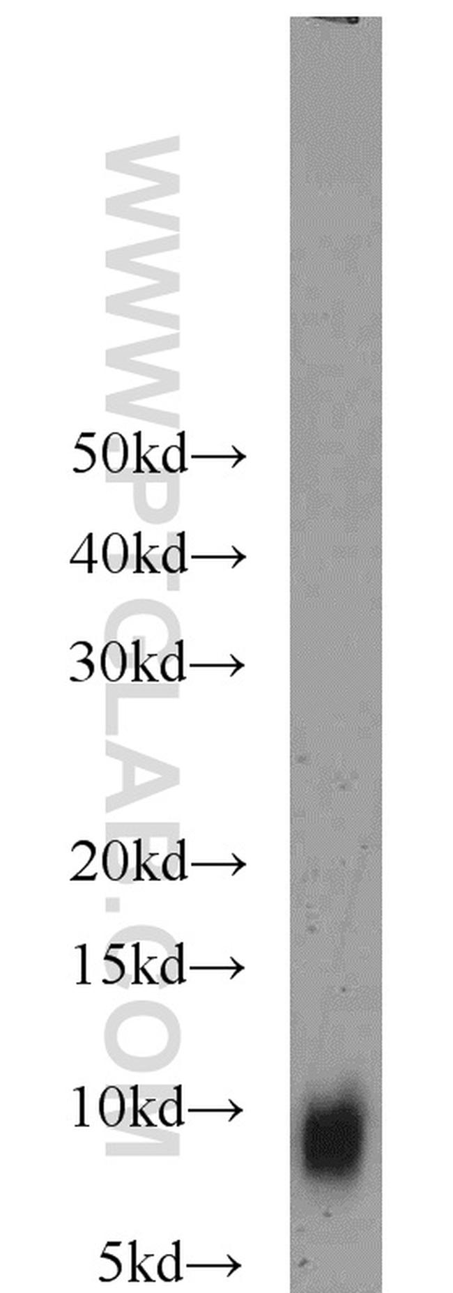 TNP1 Antibody in Western Blot (WB)