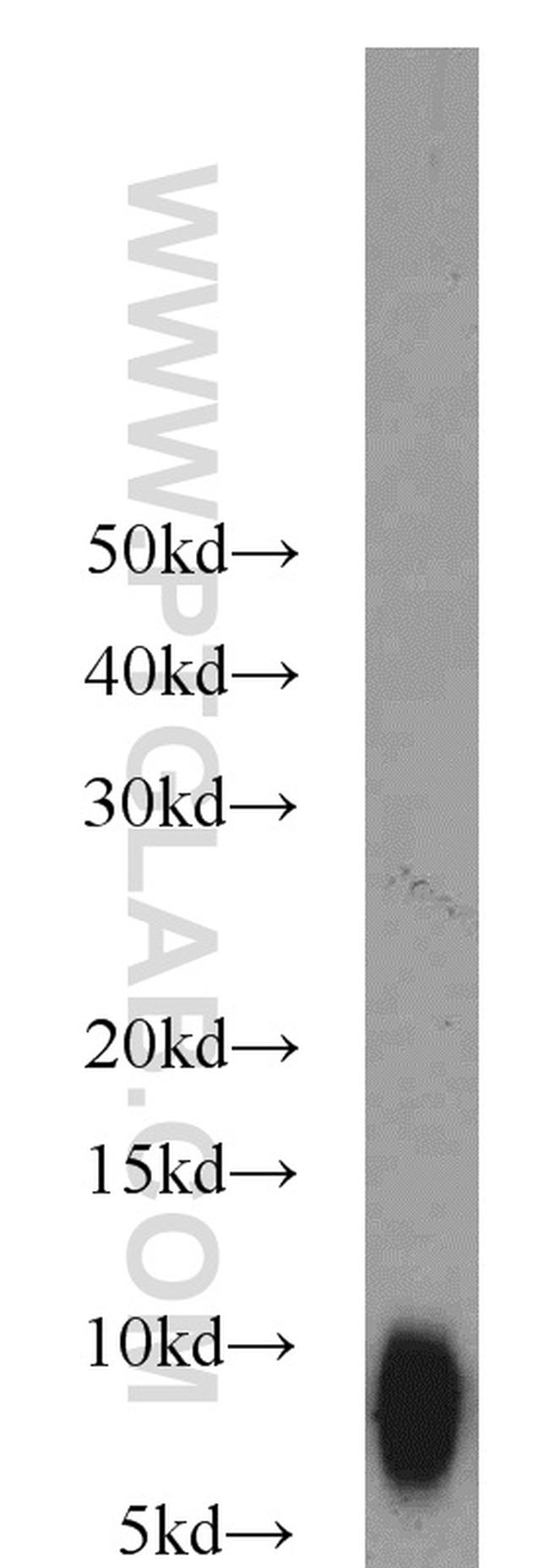 TNP1 Antibody in Western Blot (WB)