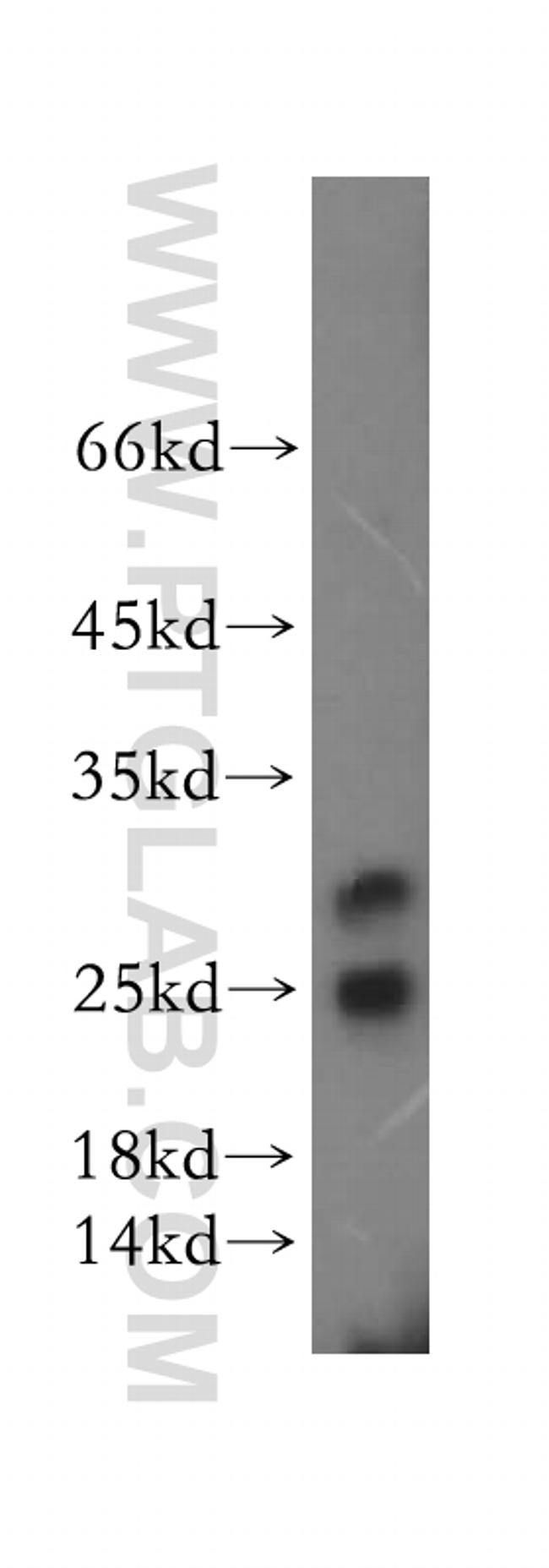 METTL11A Antibody in Western Blot (WB)