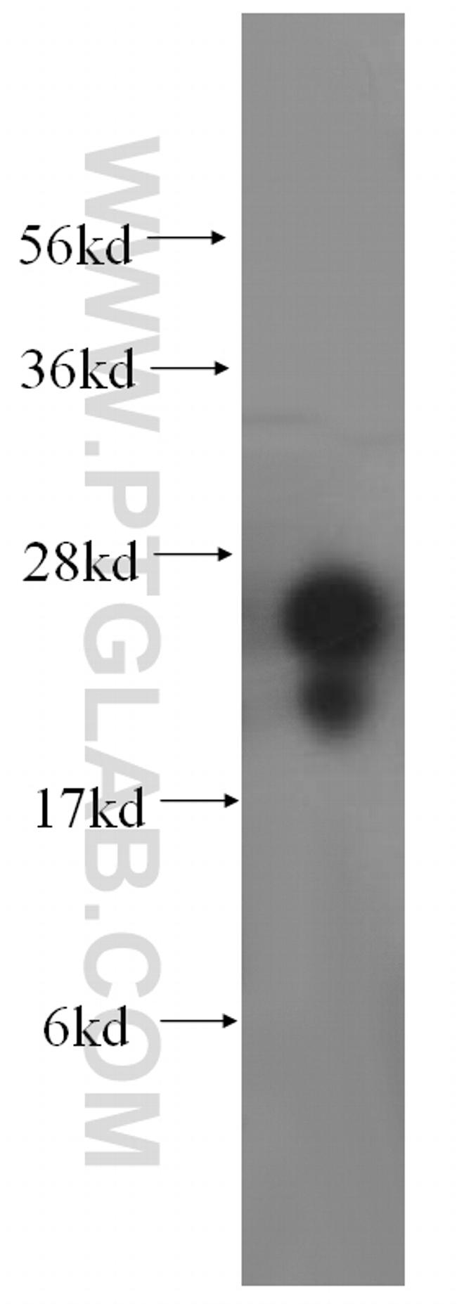 METTL11A Antibody in Western Blot (WB)