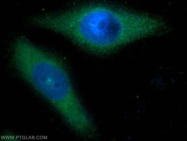 G-CSF Antibody in Immunocytochemistry (ICC/IF)