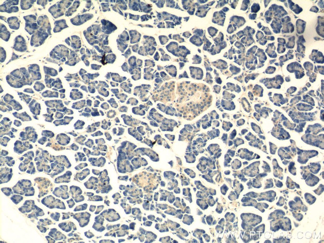 G-CSF Antibody in Immunohistochemistry (Paraffin) (IHC (P))