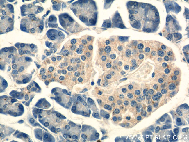 G-CSF Antibody in Immunohistochemistry (Paraffin) (IHC (P))