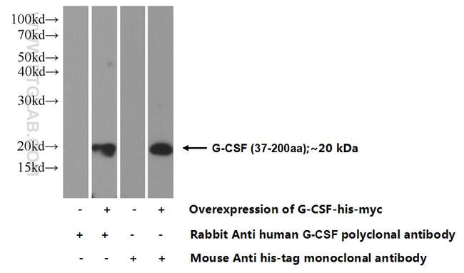 G-CSF Antibody in Western Blot (WB)