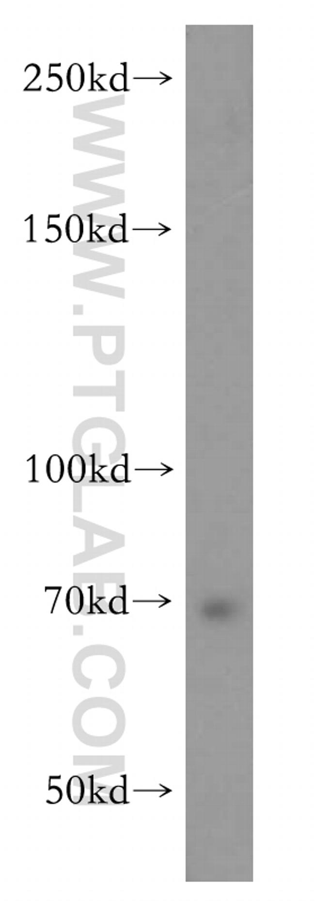 ZFP64 Antibody in Western Blot (WB)