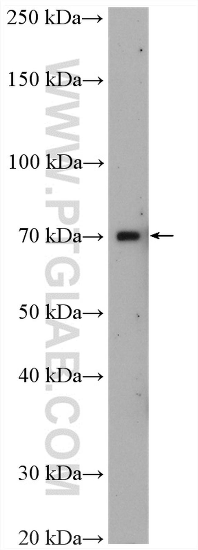 ZFP64 Antibody in Western Blot (WB)