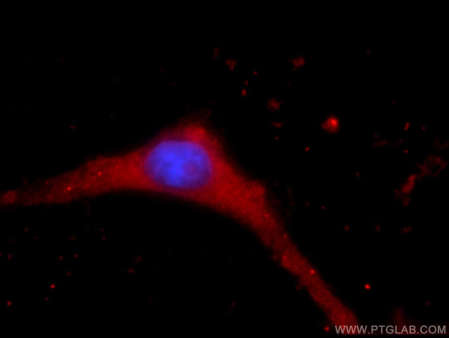 KCNN3 Antibody in Immunocytochemistry (ICC/IF)