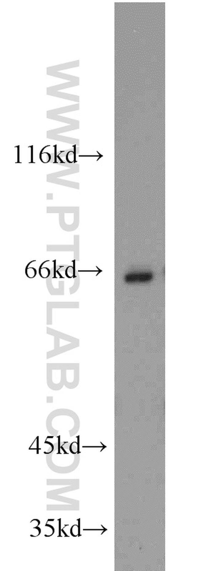CBFA2T3 Antibody in Western Blot (WB)