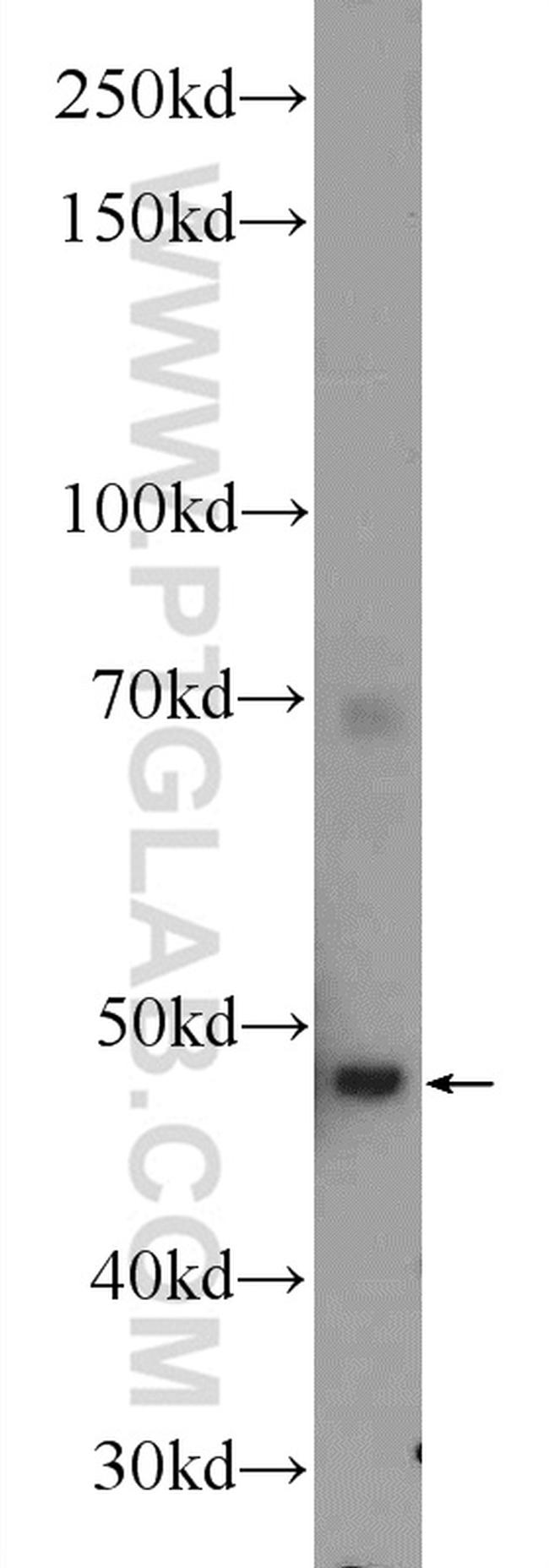 CFP Antibody in Western Blot (WB)