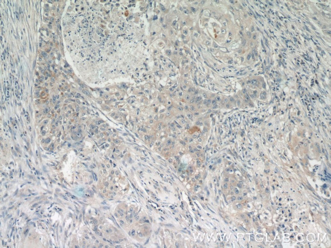 RSPO3 Antibody in Immunohistochemistry (Paraffin) (IHC (P))