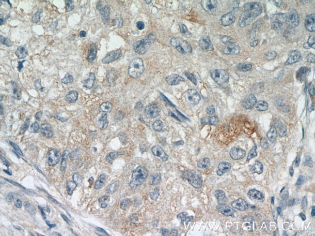 RSPO3 Antibody in Immunohistochemistry (Paraffin) (IHC (P))