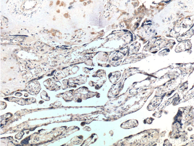 RSPO3 Antibody in Immunohistochemistry (Paraffin) (IHC (P))