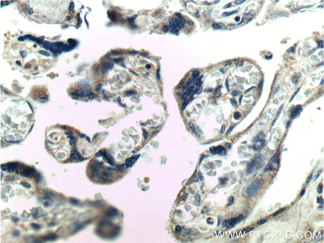 RSPO3 Antibody in Immunohistochemistry (Paraffin) (IHC (P))