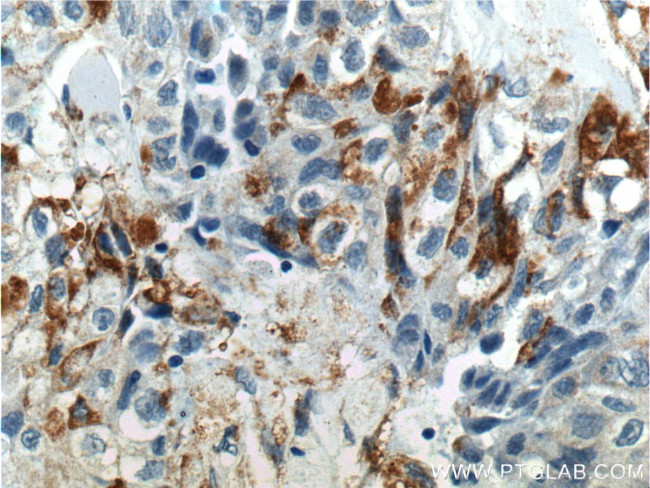 RSPO3 Antibody in Immunohistochemistry (Paraffin) (IHC (P))