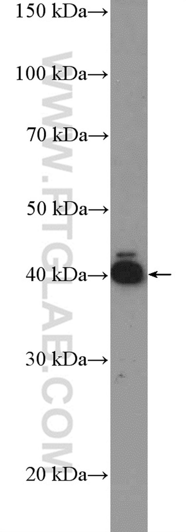 RSPO3 Antibody in Western Blot (WB)