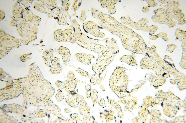 MGMT Antibody in Immunohistochemistry (Paraffin) (IHC (P))