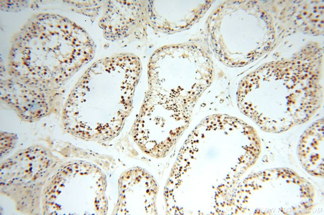 MGMT Antibody in Immunohistochemistry (Paraffin) (IHC (P))