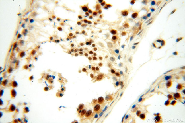 MGMT Antibody in Immunohistochemistry (Paraffin) (IHC (P))